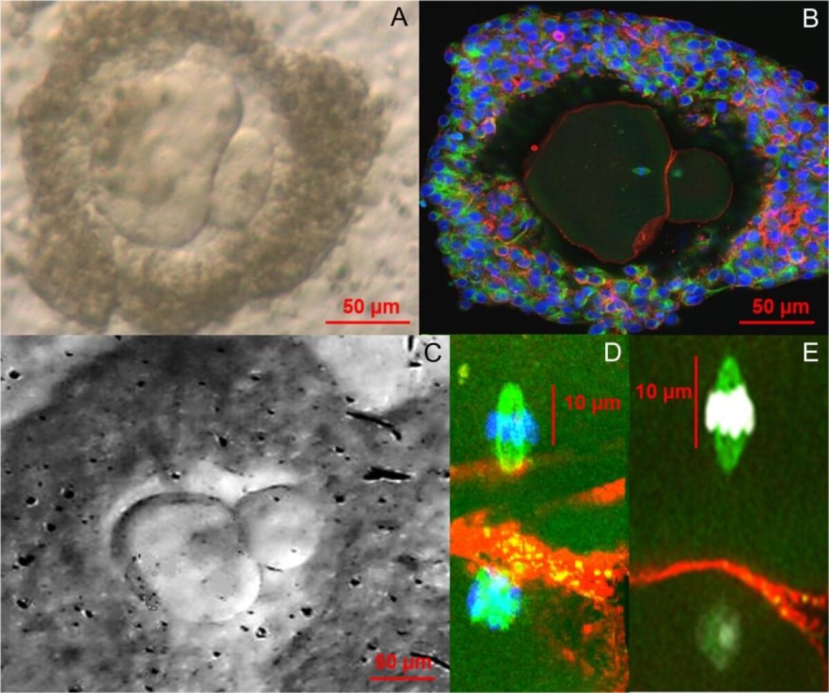 Coltivare ovociti umani in laboratorio non è impossibile - Ph: Metaphase II oocytes from human unilaminar follicles grown in a multi-step culture system