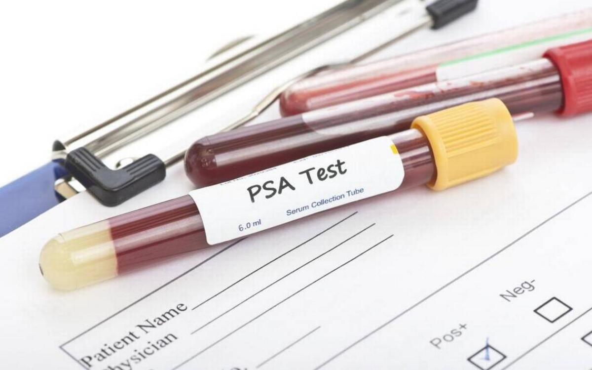Il PSA è un buon marcatore tumorale? - Ph: idahostatesman.com