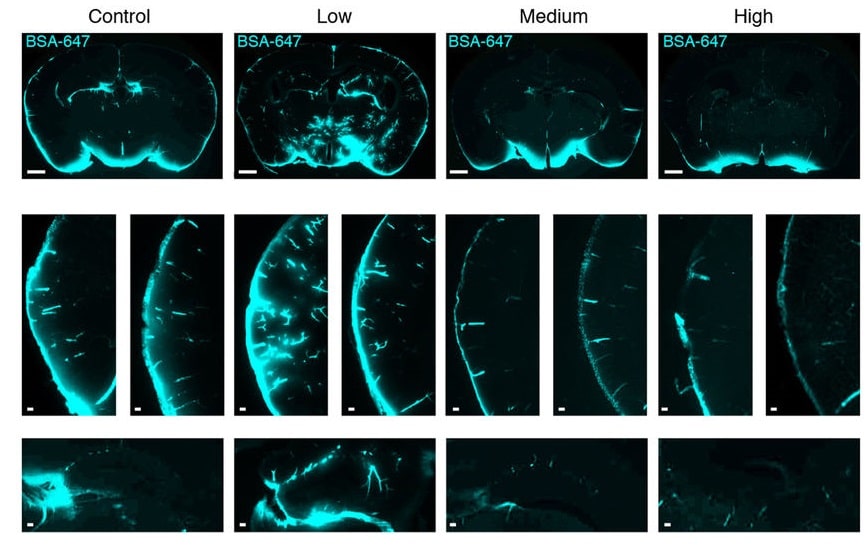 Sezioni coronali del cervello dei topi dopo l'assunzione di diverse dosi di alcol Ph: nature.com