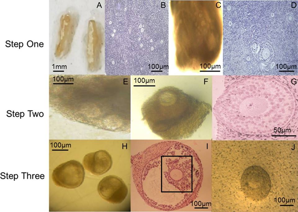 Ph: Metaphase II oocytes from human unilaminar follicles grown in a multi-step culture system