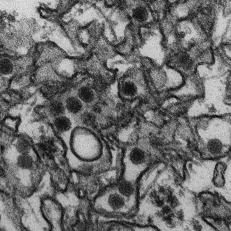 Il virus Zika osservato al microscopio elettronico (diametro particelle di 40 nm). Crediti: CDC/ Cynthia Goldsmith