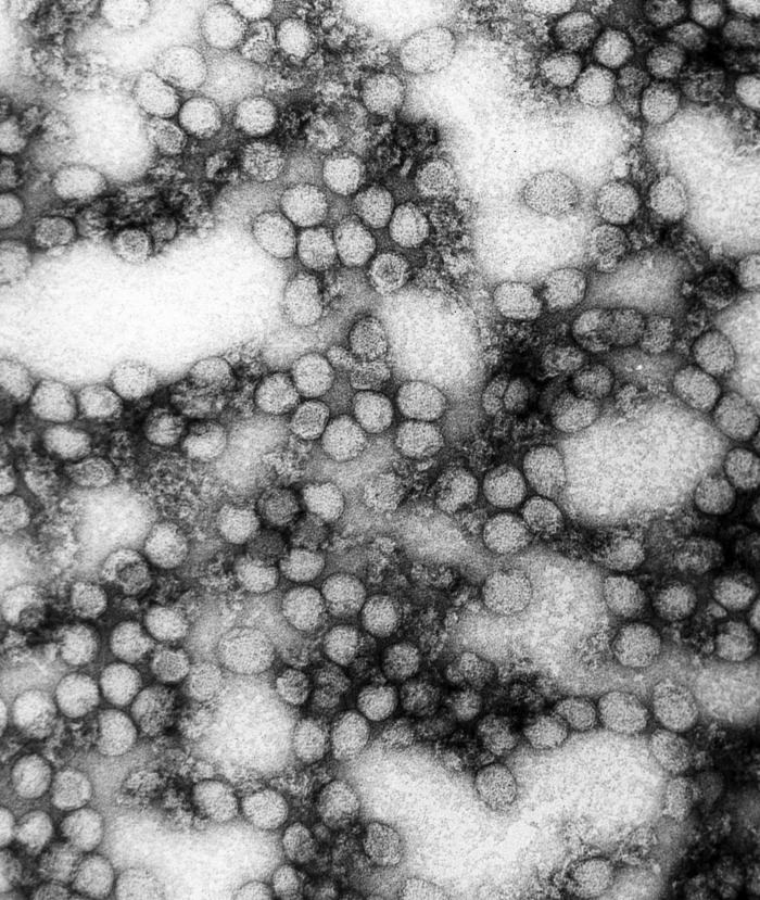 Microscopia elettronica del virus della febbre gialla, crediti: Erskine Palmer, Ph.D. - Centers for Disease Control and Prevention Publich Health Image Library.