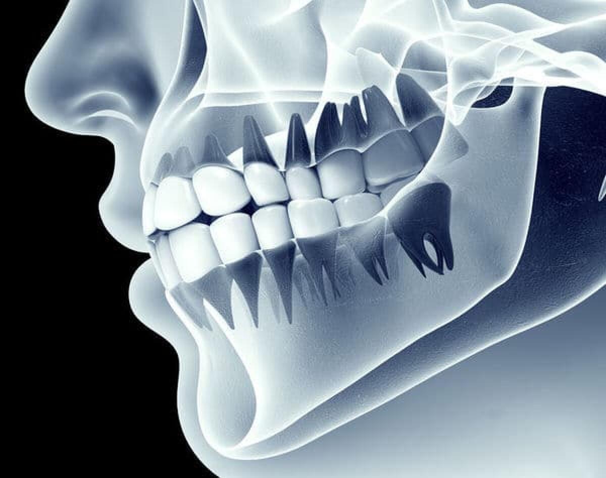 Rigenerazione dentale, nuova frontiera dell'odontoiatria - Dental regeneration, crediti: jbpress.ismedia.jp