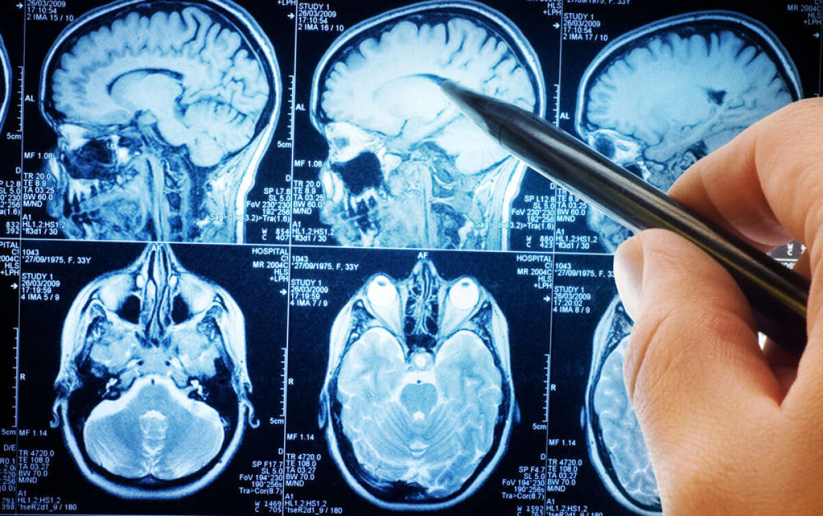 Epilessia: la tecnologia che può salvarti la vita - PH: mondino.com