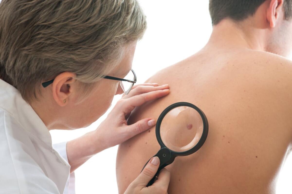 Una ricerca veronese contro il melanoma - 