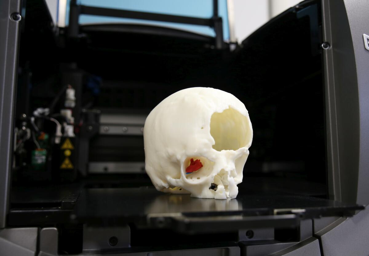 Rimosso con successo un tumore in modo non invasivo grazie alla stampa 3D - Modello di stampa 3D con la riproduzione della massa tumorale scattata da G. Righi