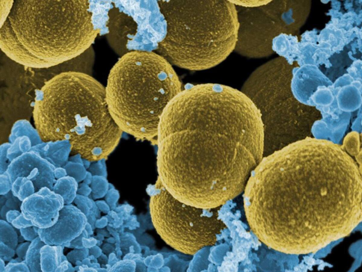 Antibiotico resistenza: due nuove molecole per combatterla - Ph. elindependiente