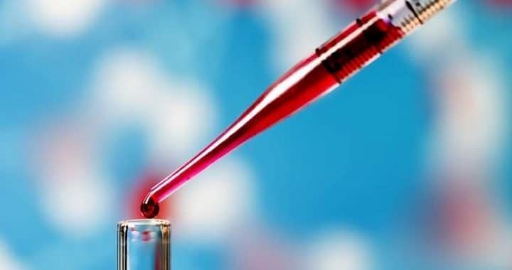 Trattamento preventivo del prelievo ematico.