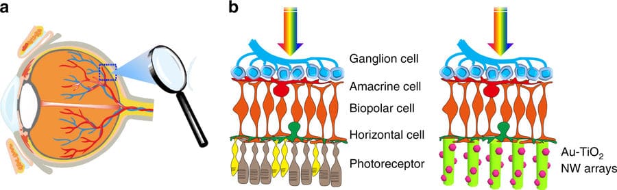 Interfaccia nanocavi-retina. A)Illustrazione dell'occhio. B)Comparazione retina-fotorecettori (necrotici) e retina-nanocavi. Ph: Tang et al.