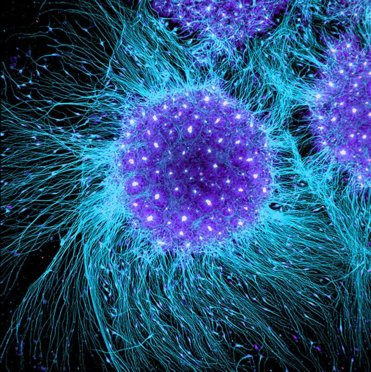 Cellule staminali : finalmente l'introduzione nella pratica clinica - Rosette neurali, crediti: Gist Croft/Ali Brivanlou/Rockefeller University