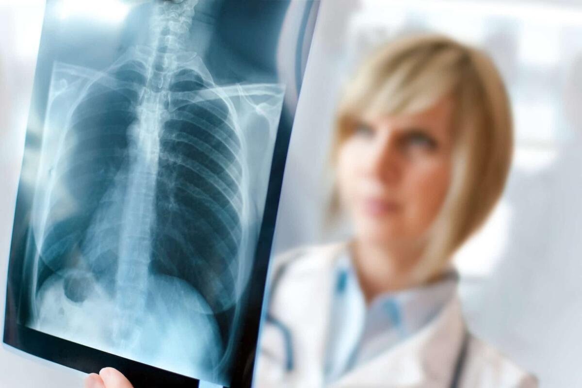 La radiologia non sarà più la stessa grazie all'intelligenza artificiale - 