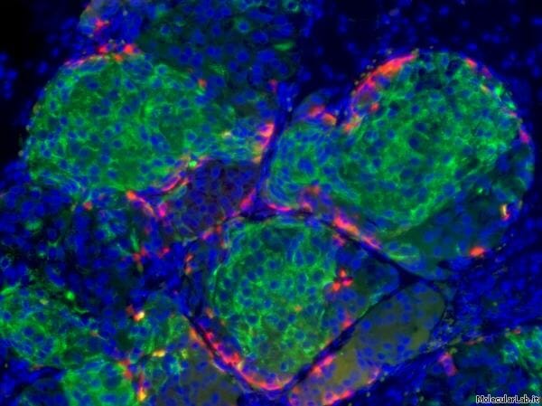 Cellule beta-pancreatiche ottenute da staminali embrionali.Crediti : MolecularLab.it