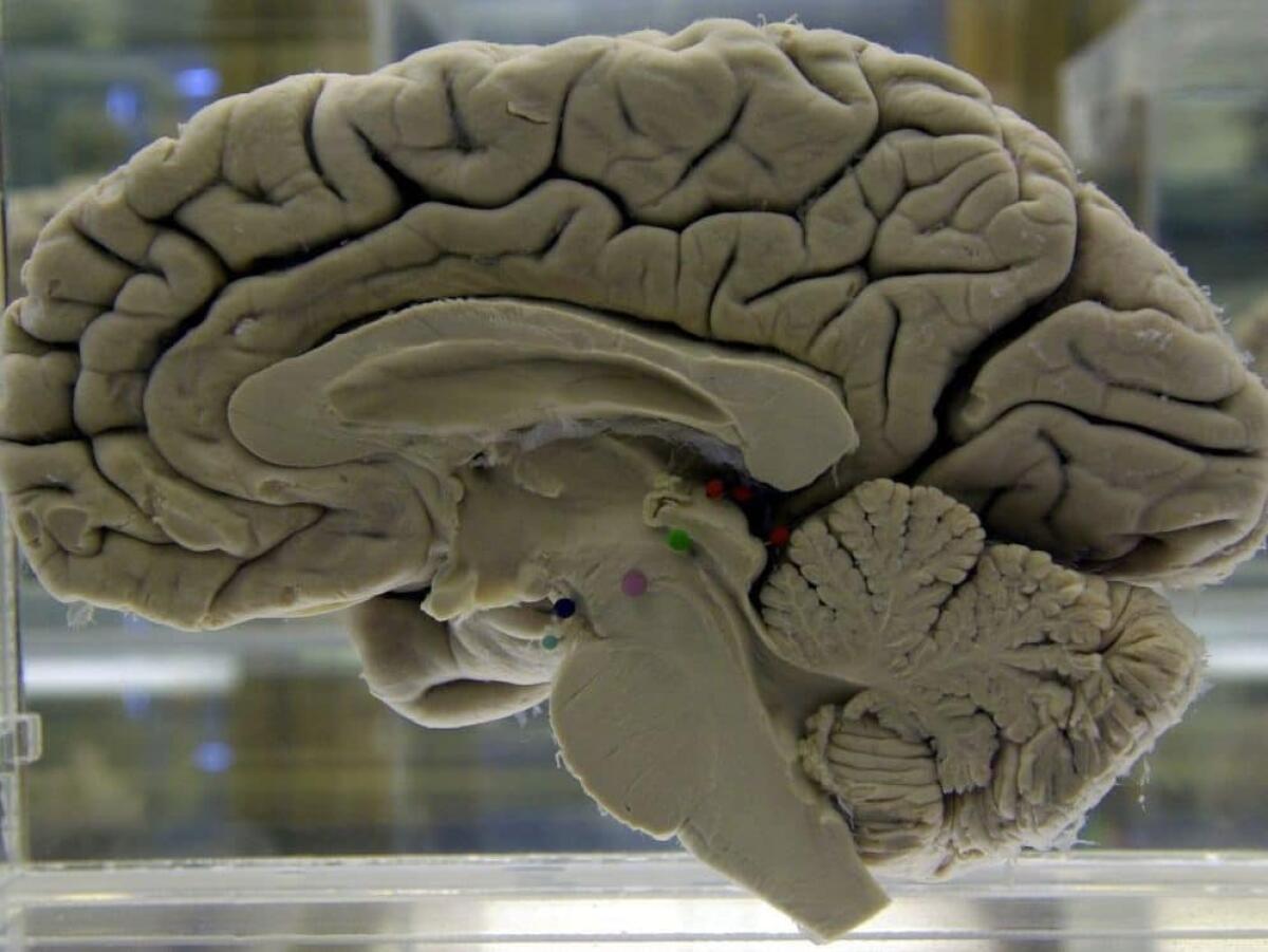 Alzheimer e virus: scoperta una correlazione fra infezione e degenerazione neuronale - 