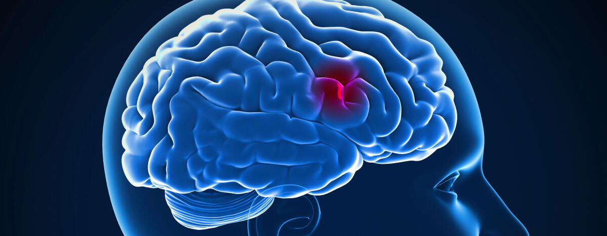 Un gel per riparare i tessuti colpiti da ictus - PH: http://stjohn.ab.ca