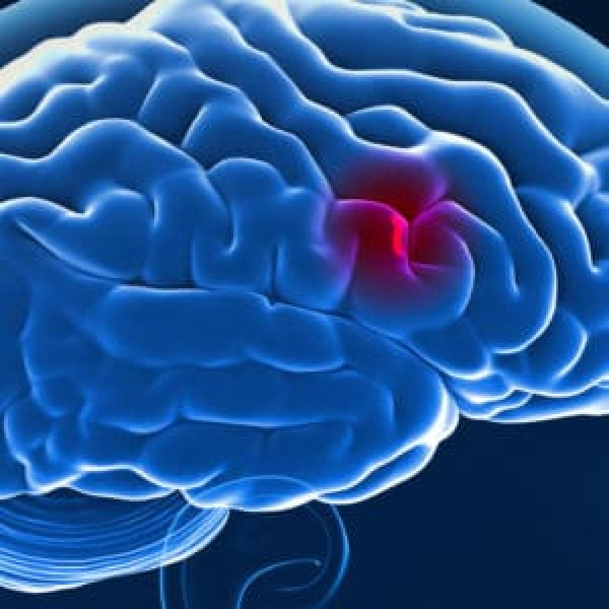 Un gel per riparare i tessuti colpiti da ictus - PH: http://stjohn.ab.ca