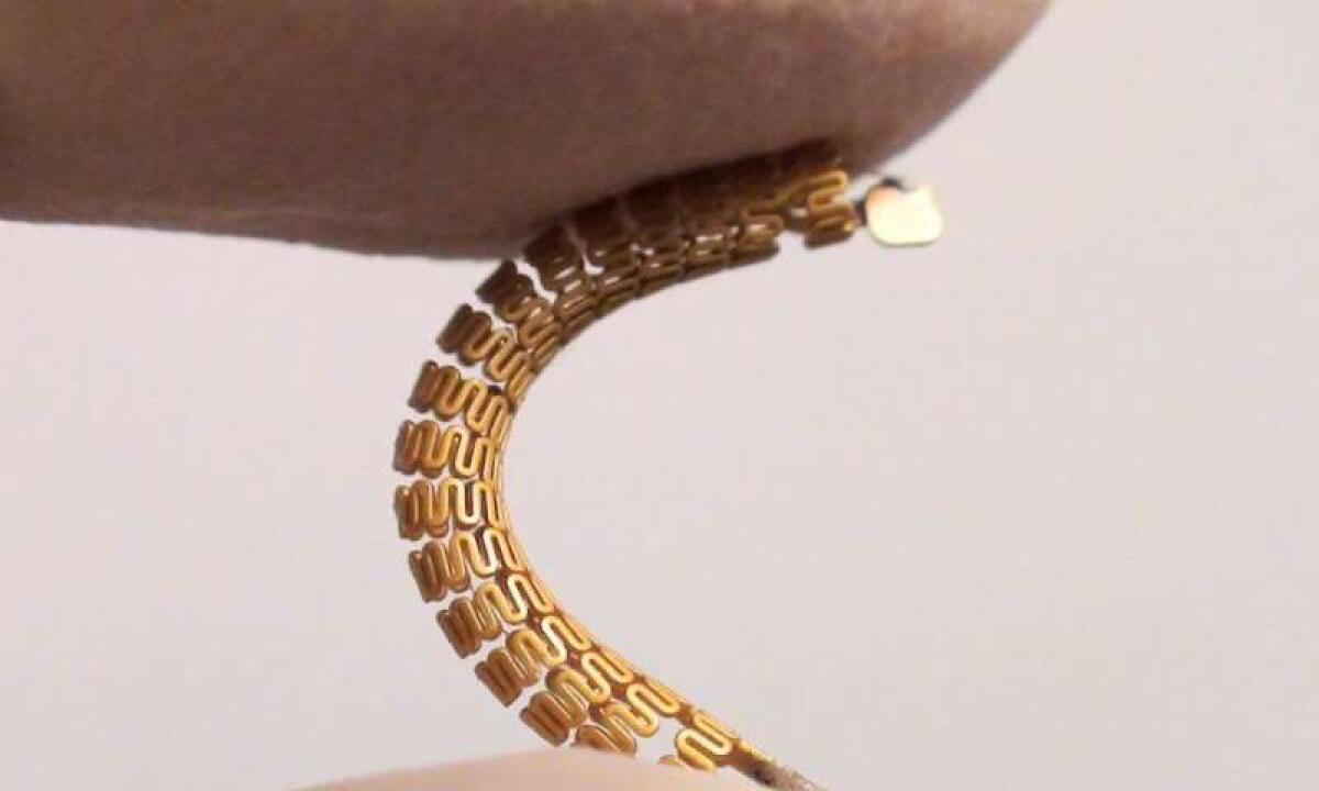 Uno "stent intelligente" che monitora il restringimento delle arterie - Stent intelligente