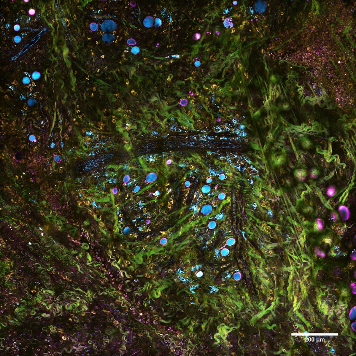 Nuova tecnica di imaging tissutale per mappare la progressione dei tumori - Nuova tecnica di imaging tissutale per mappare la progressione dei tumori
Credits: Stephen Boppart/University of Illinois