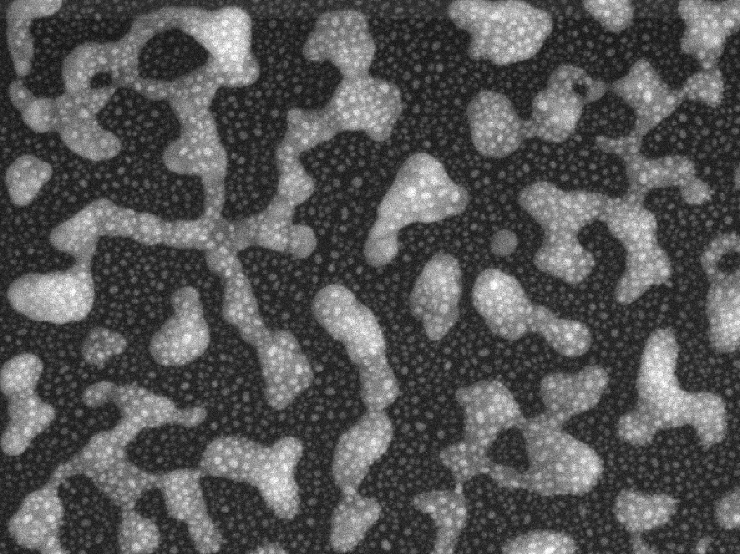 Un'immagine al microscopio elettronico a scansione mostra la superficie di un nuovo chip. La superficie è costituita da nanoparticelle d'oro (piccoli punti luminosi) che sono state depositate su nanoparticelle d'argento (regioni grigio chiaro) per formare