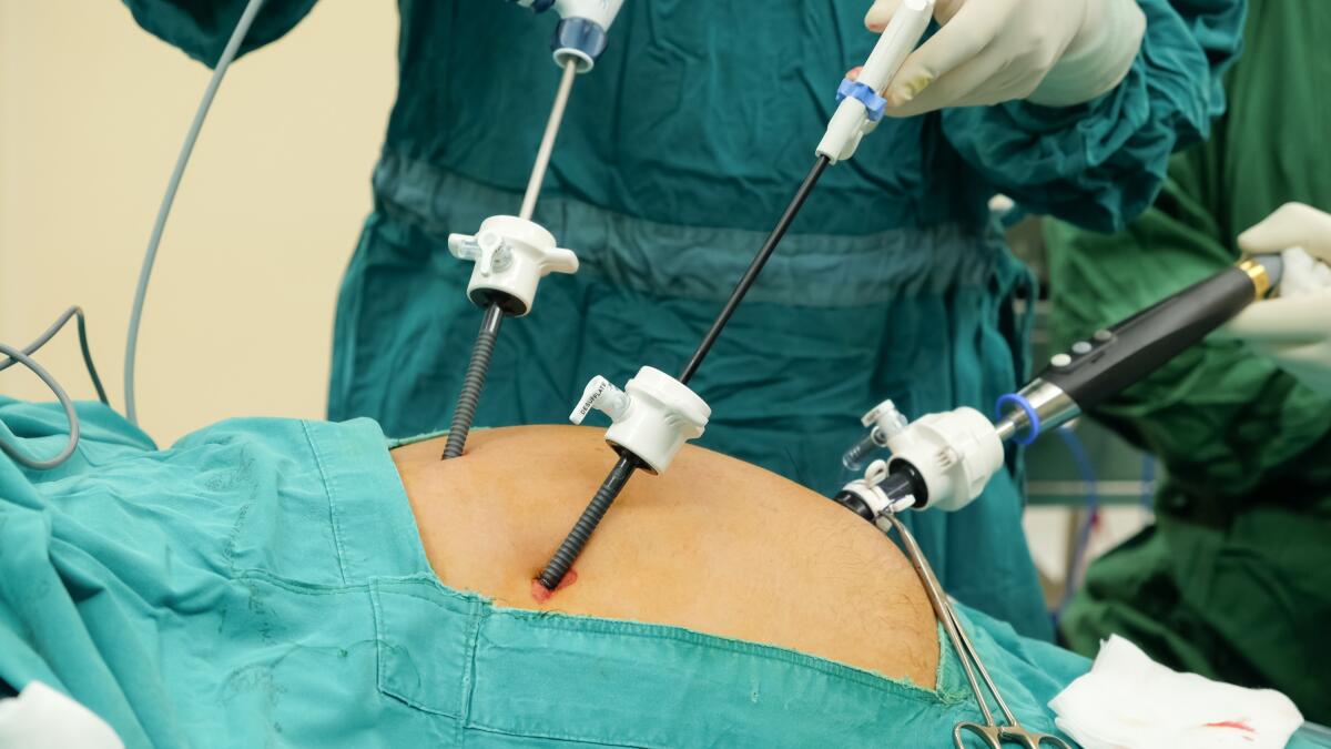 Laparoscopia: funzionamento, strumentazione e vantaggi - Laparoscopia
