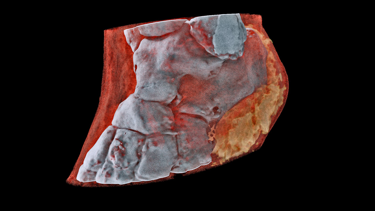 Scansione di una cavigliaCredits: Mars Bioimaging Ltd