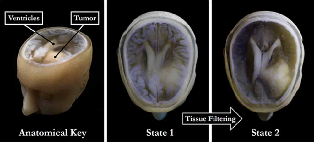 Credits: James Weaver and Steven Keating/Wyss Institute at Harvard University