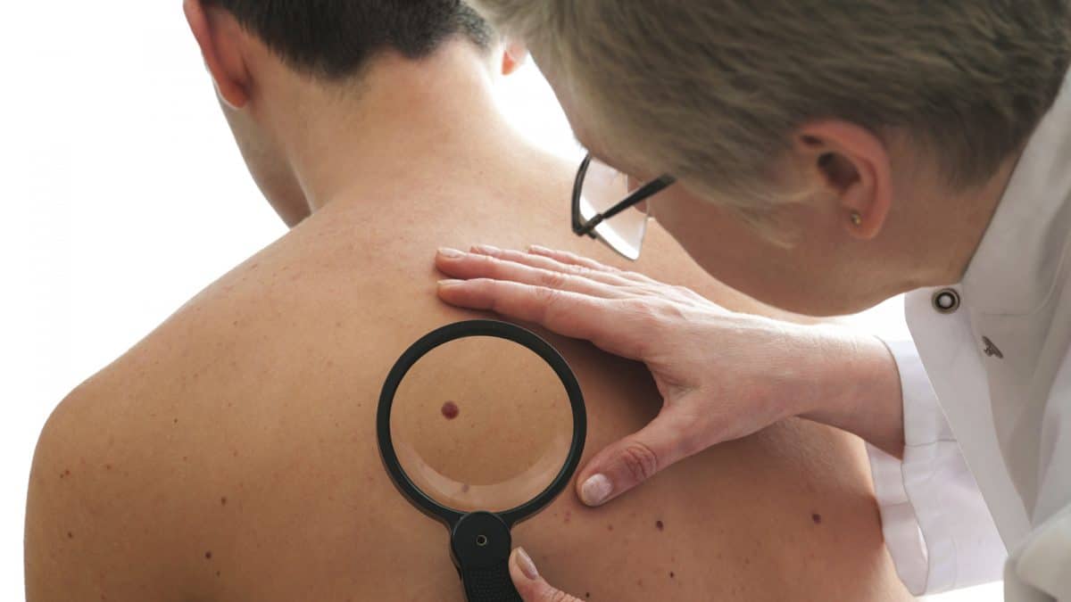 Un nuovo esame del sangue che rileva il cancro meglio di una biopsia