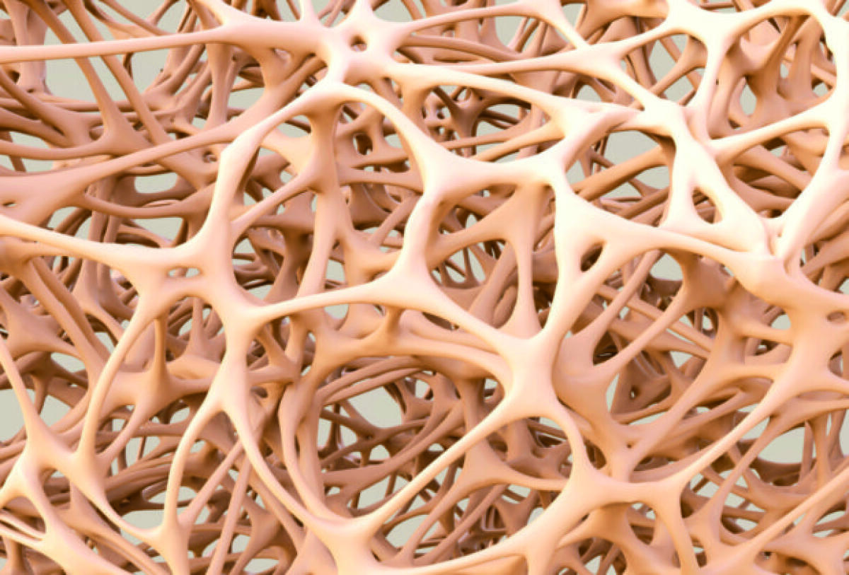 Uno scaffold biomimetico per studiare l'osteoporosi: una ricerca italiana - osteoporosi