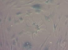 Cellula senescente nel corpo umanoph:exeter.ac.uk