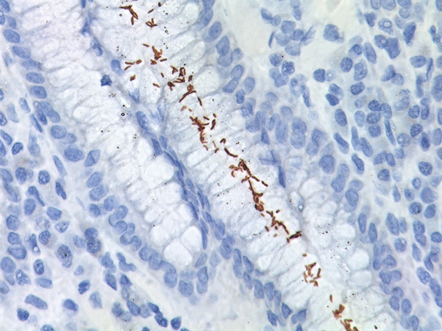 Infezione da H. piloriCredits: biocare.net