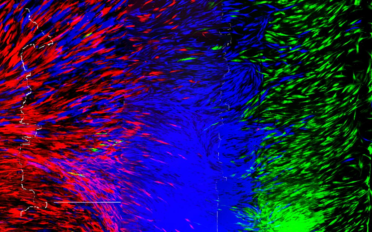 Arrivano i primi tendini e legamenti umani stampati in 3D - Ph: University of Utah