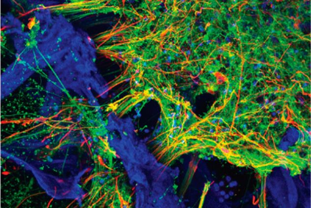 Modello di rete neurale in 3D in vitro: è possibile osservare i neuroni del morbo di Alzheimer (in verde), la matrice porosa (in blu) e gli astrociti (in rosso).Image credit: Tufts University