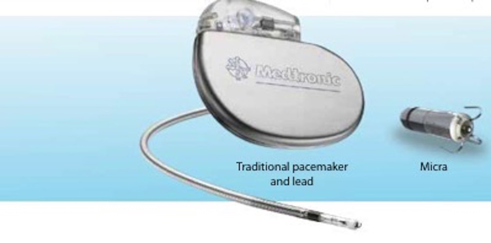 Nell'illustrazione il dispositivo Micra TPS posto a confronto con un pacemaker tradizionale                          PH: oliversegal.com