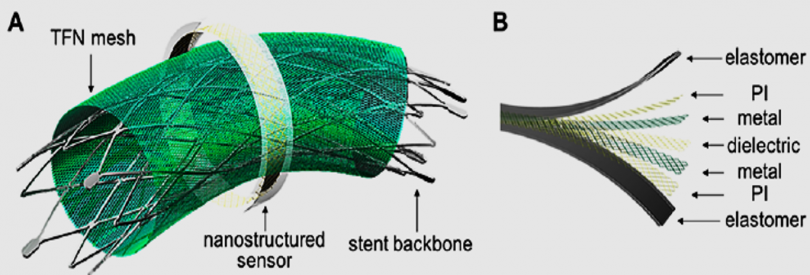 (A) Sensore di flusso integrato nel flow diverter in nitinol (TFN). (B) Struttura del sensore capacitivo di flusso. PH: ingegneriabiomedica.org