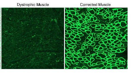 1. A sinistra si può vedere una immagine in fluorescenza di cellule malate prive di distrofina sana. 2. A destra invece si può osservare un campione di cellule dopo il trattamento. La risposta di fluorescenza è nettamente superiore, a conferma della prese