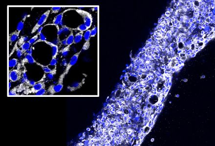 Tessuti creati in laboratorio per riprodurre malattie renali e osservare le risposte a diversi trattamenti farmacologici  PH: marionegri.it