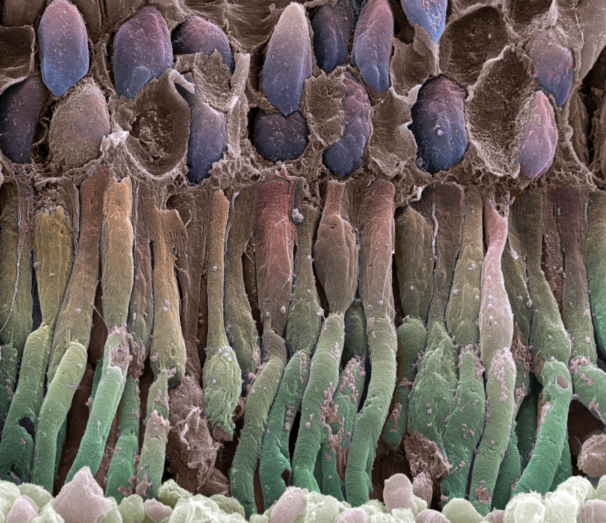 Trapianto di cellule nella retina efficace sui topi - Retina rod cells, crediti: sciencesource.com