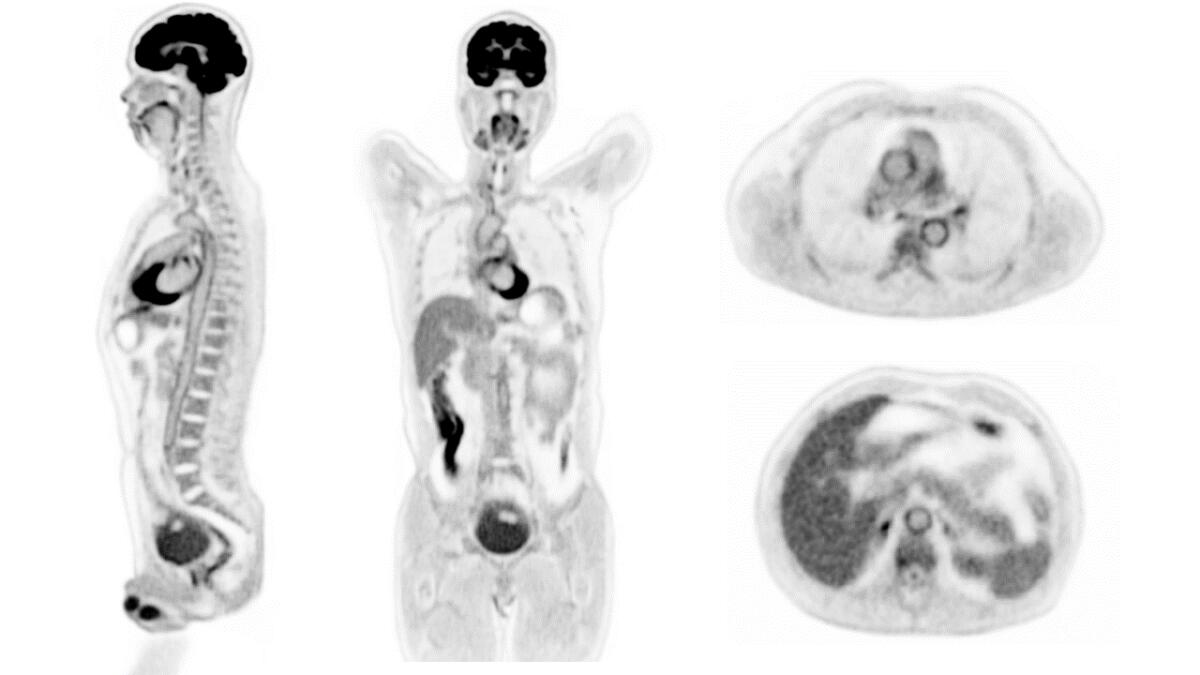 EXPLORER: il primo scanner al mondo per immagini 3D total body - Immagini ottenute con EXPLORER.
Ph: UC Davis
