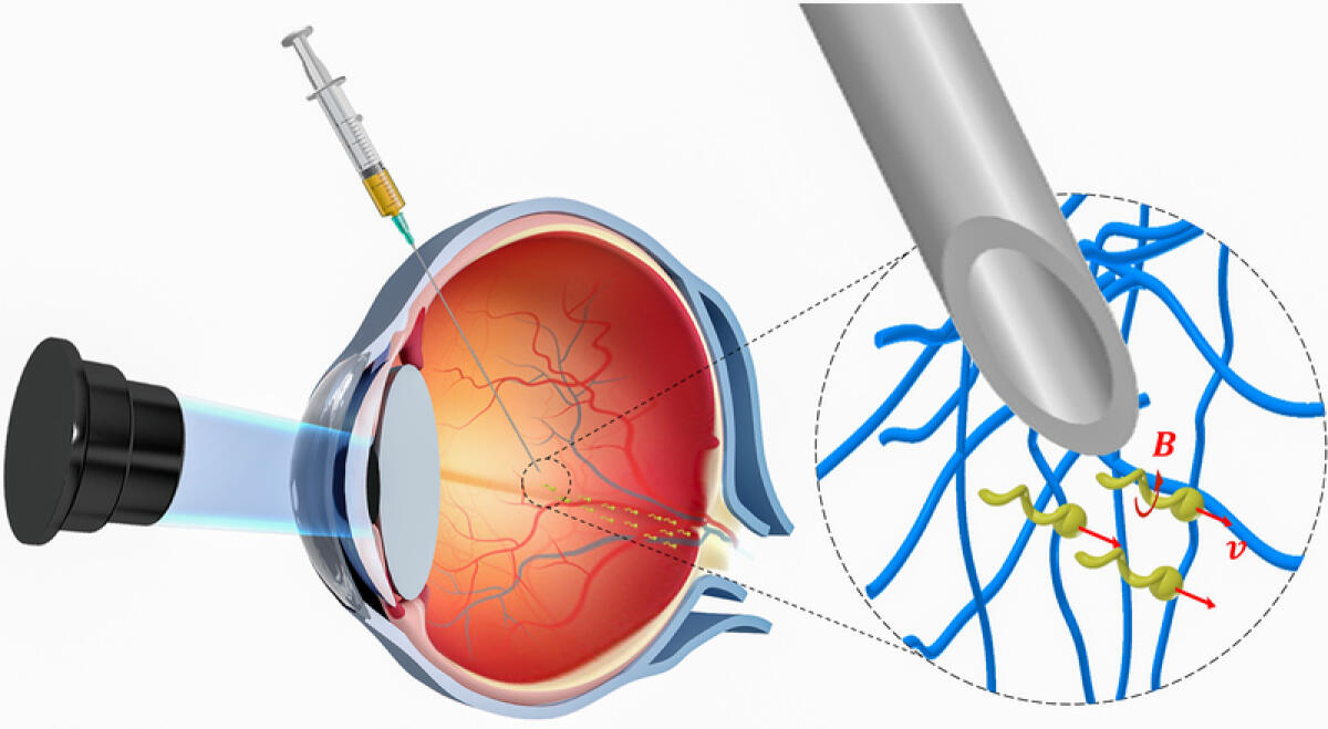 Nanorobot per raggiungere le profondità dell'occhio con minima invasività - Nanorobot per raggiungere le profondità dell'occhio con minima invasività
Credits: Max Planck Institute for Intelligent Systems