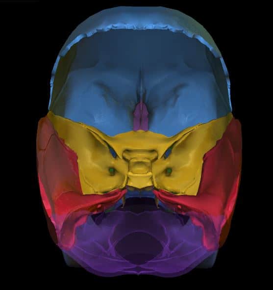 Visione posteriore del cranio. Sono state rimosse le ossa parietali; l'occipitale è posto in trasparenza per dar risalto alla presenza dei numerosi fori cranici.Immagine di Innocenzi Antonio ottenuta con Anatomy Learning.