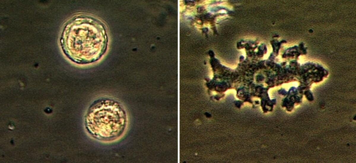 Un’infezione da ameba che può essere fatale - Ph: www.cdc.gov