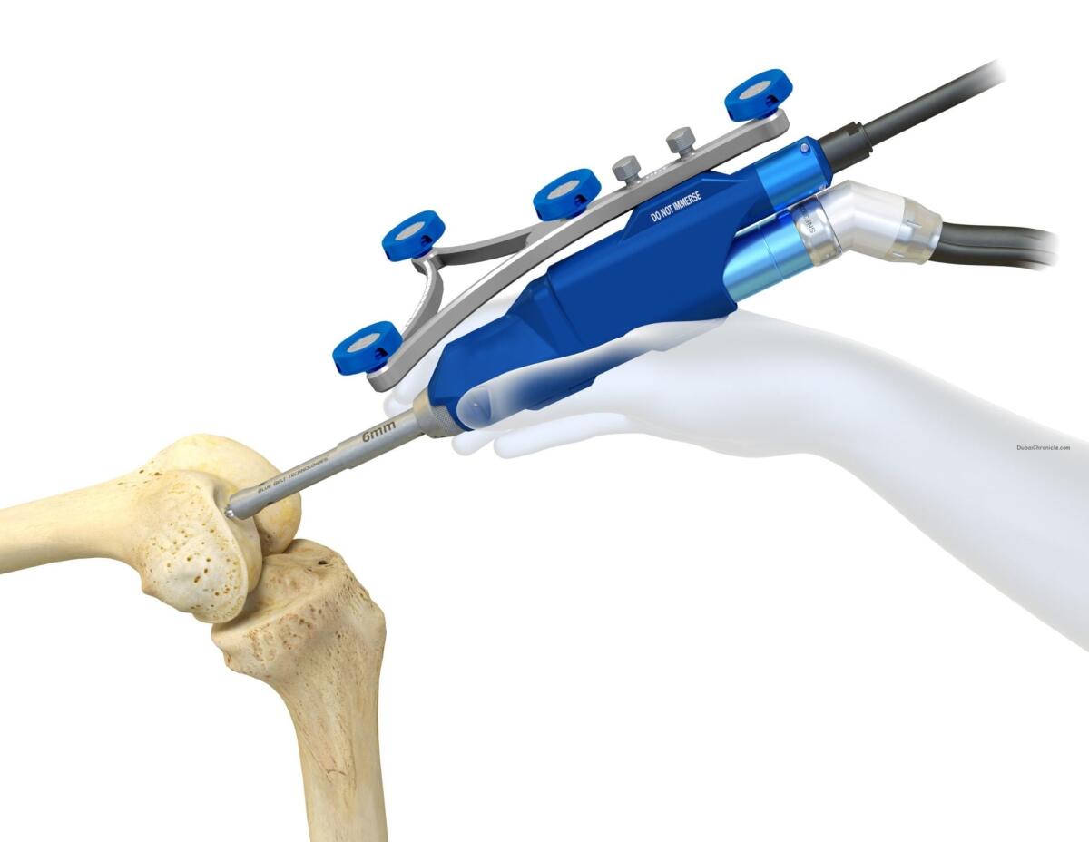 Napoli: primo intervento di chirurgia robotica ortopedica in Campania - NAVIO Surgical System
Image credits: http://www.dubaichronicle.com