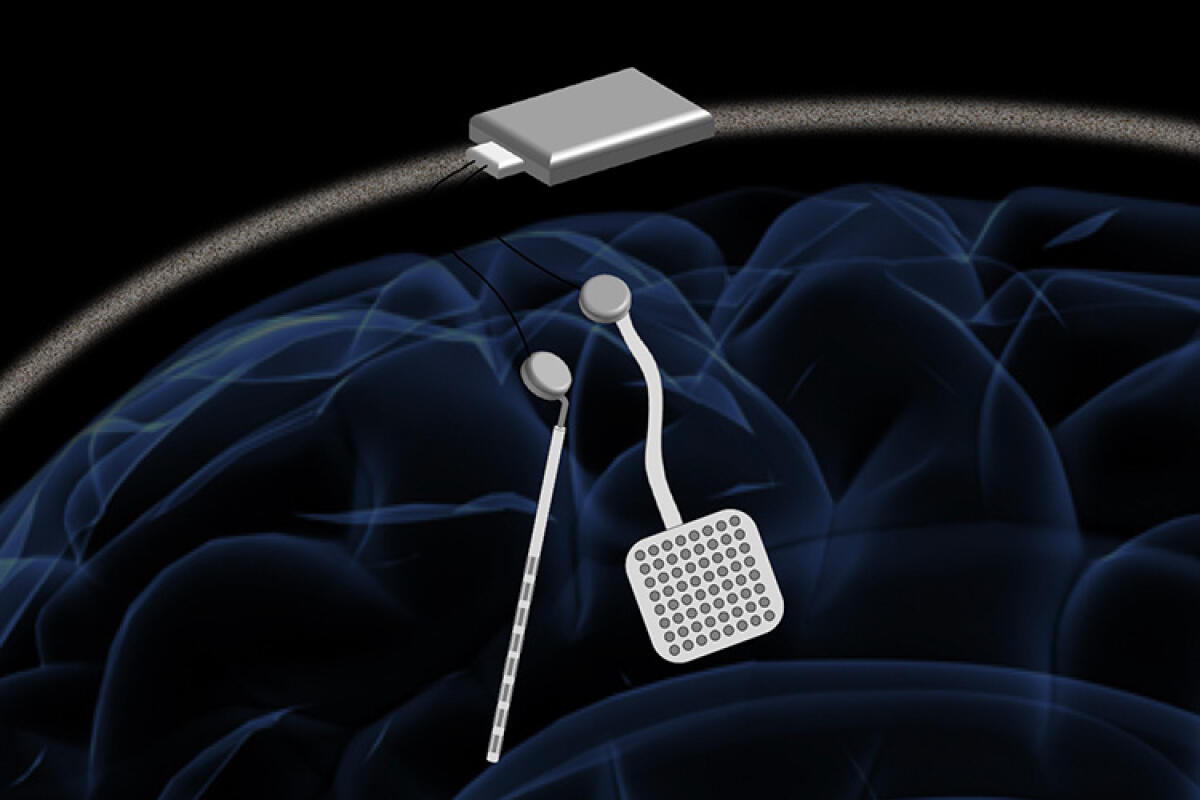 WAND: l'impianto cerebrale finanziato dalla fondazione di Zuckerberg - WAND: l'impianto cerebrale finanziato dalla fondazione di Zuckerberg
Credits: UC Berkeley - Rikky Muller