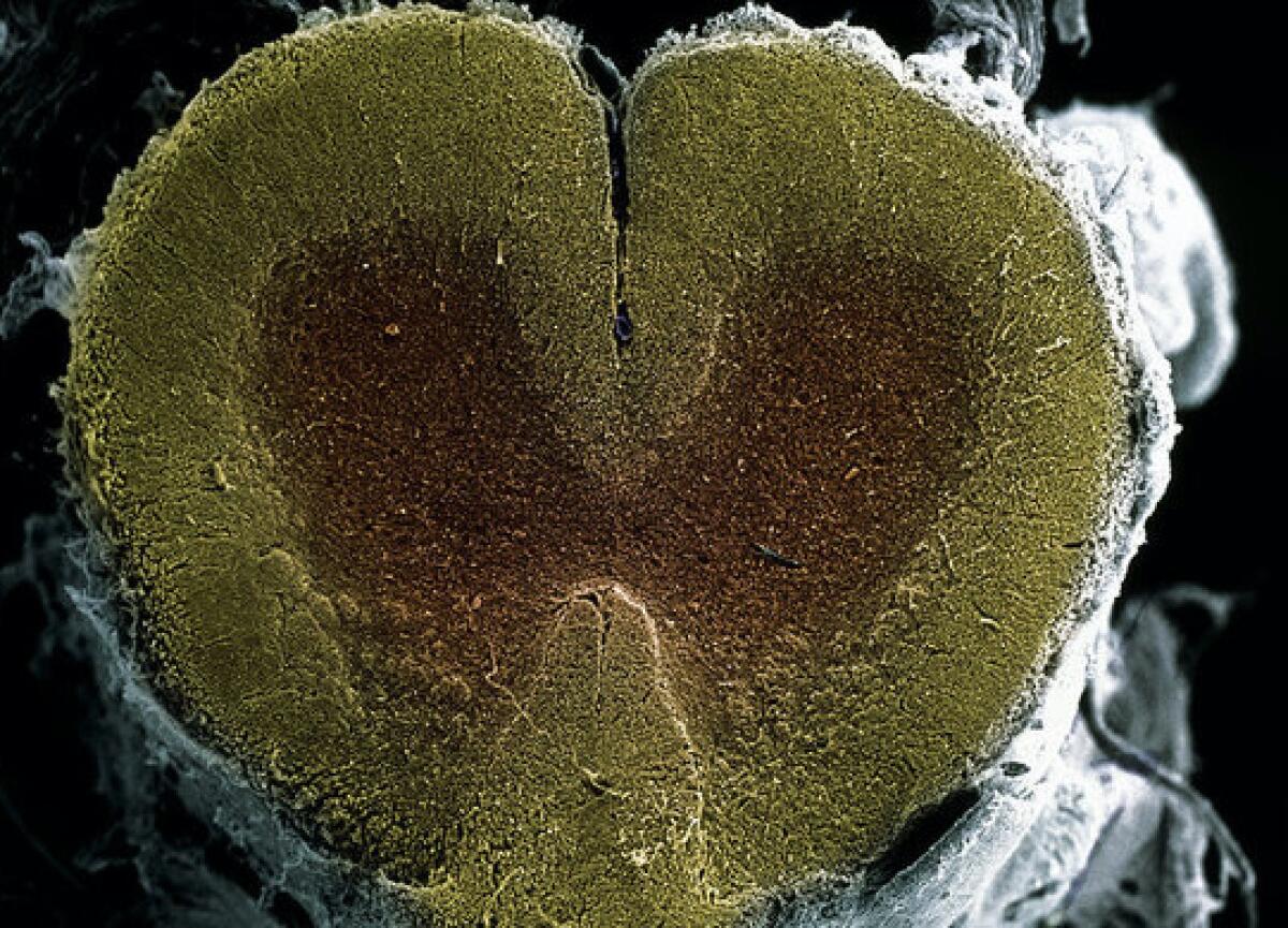 Arriva il primo midollo spinale stampato 3D - midollo spinale