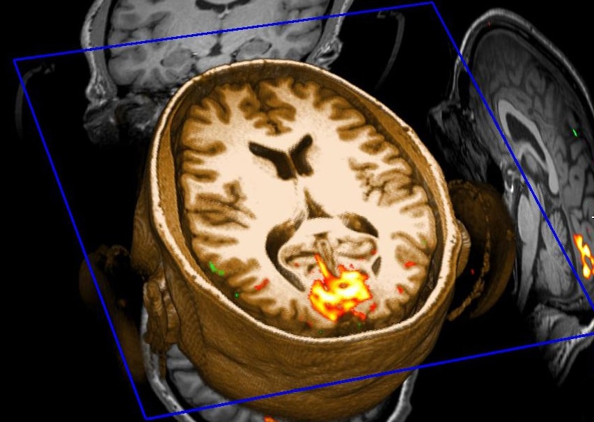 Ph: cedars-sinai.edu