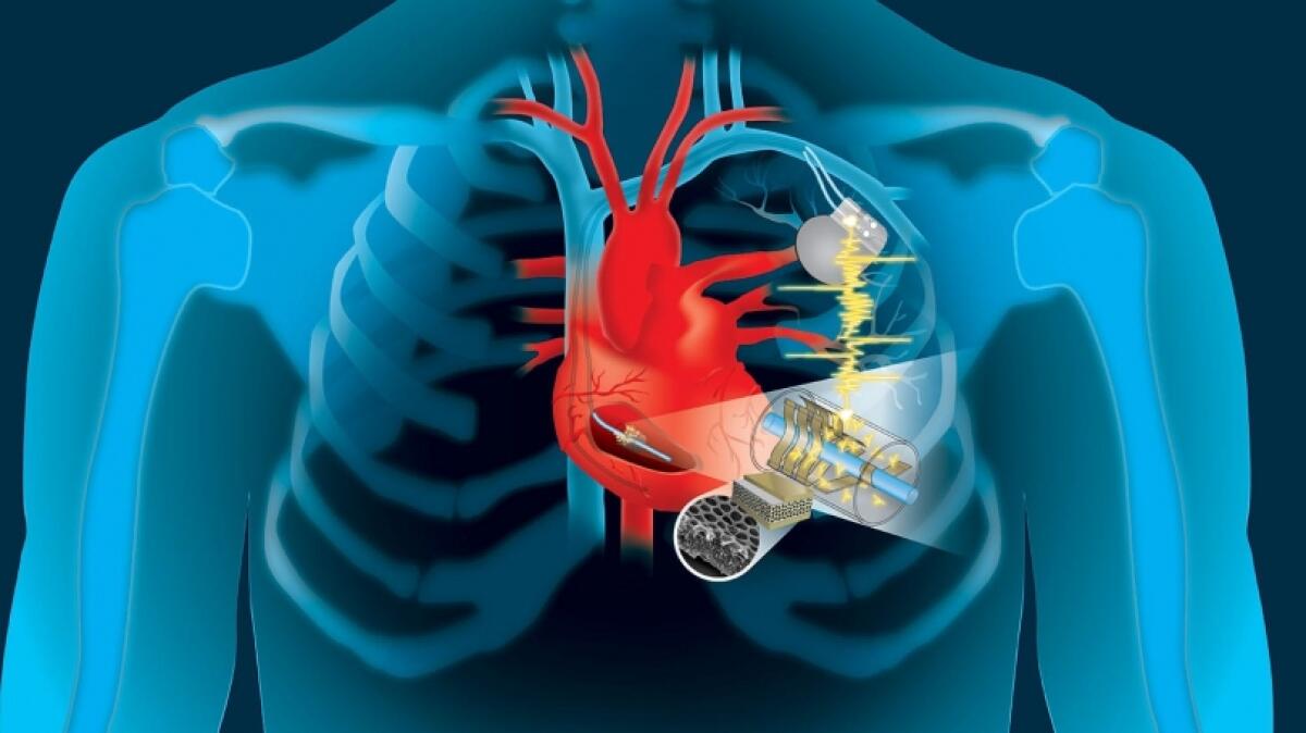 Alimentare i pacemaker con i battiti del cuore: una soluzione possibile - Alimentare i pacemaker con i battiti del cuore: una soluzione possibile
Credits: Thayer School of Engineering