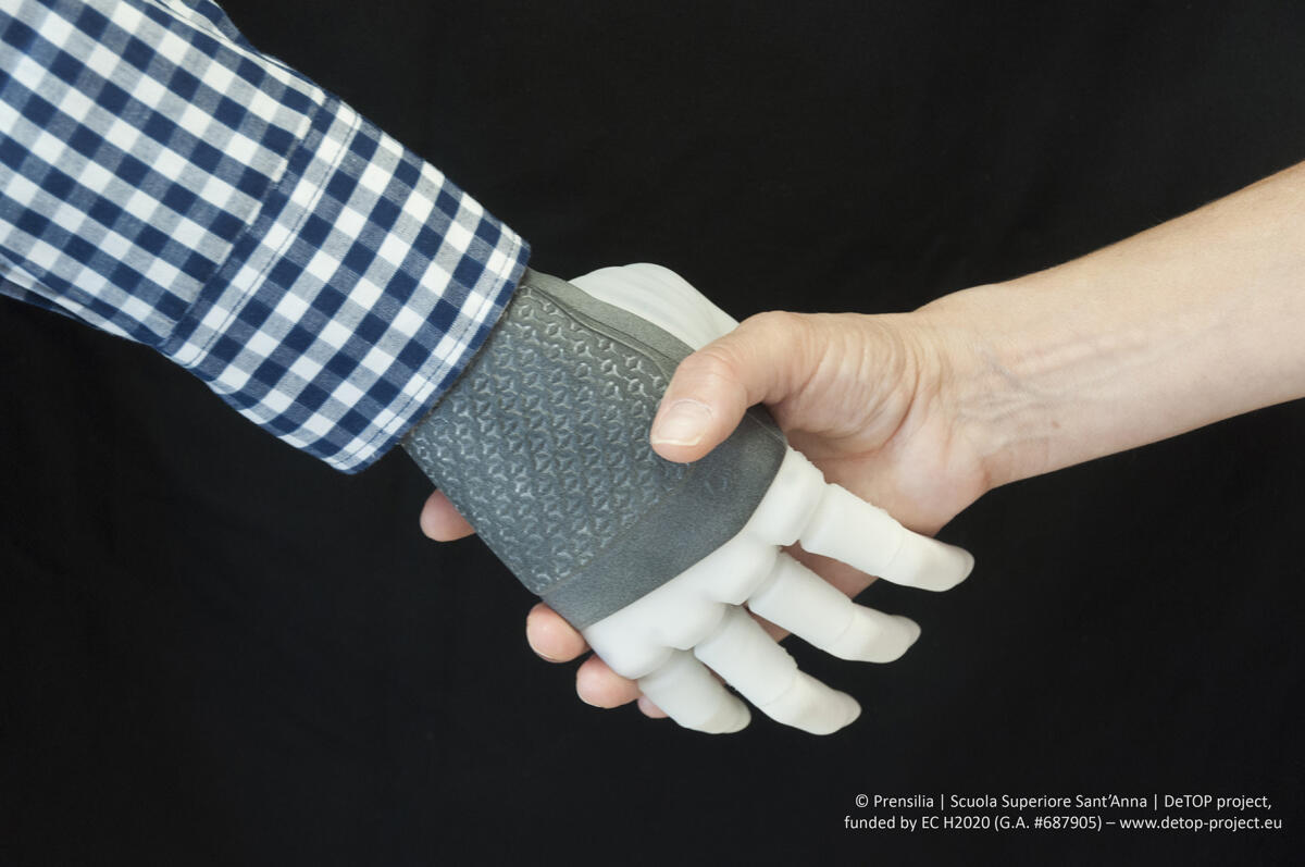 Dall'Italia alla Svezia: impiantata la prima mano robotica permanente - Dall'Italia alla Svezia: impiantata la prima mano robotica permanente
Credits: Prensilia, Scuola Superiore Sant'Anna, DeTOP project