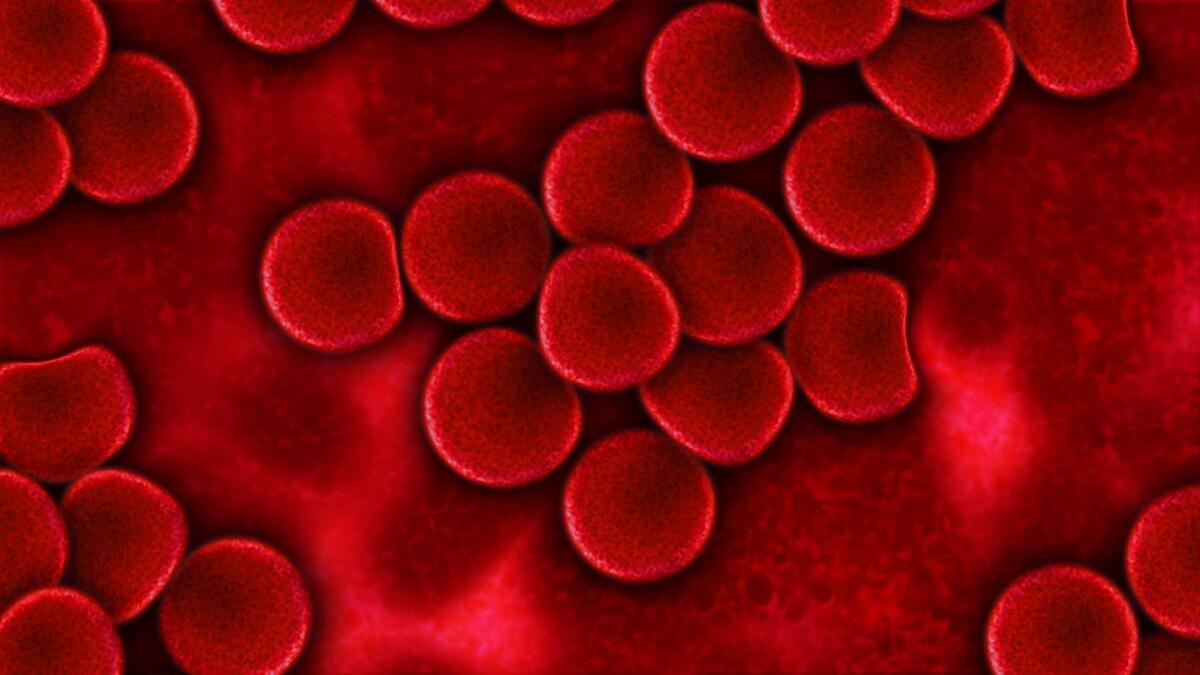 SmartMicroOptics annuncia il nuovo prodotto DIPLE su Mamacrowd - 