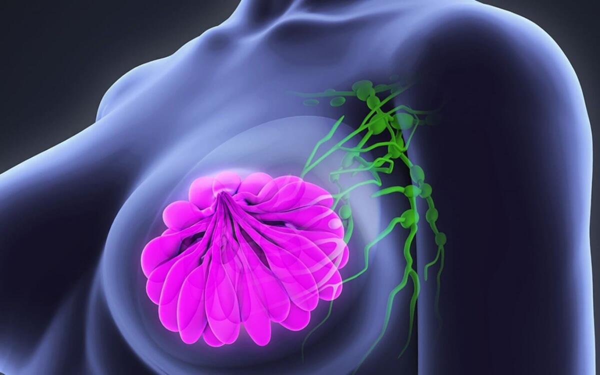 Cancro al seno, scoperti geni che possono predire il rischio - Cancro al seno, crediti: studiofmp.com
