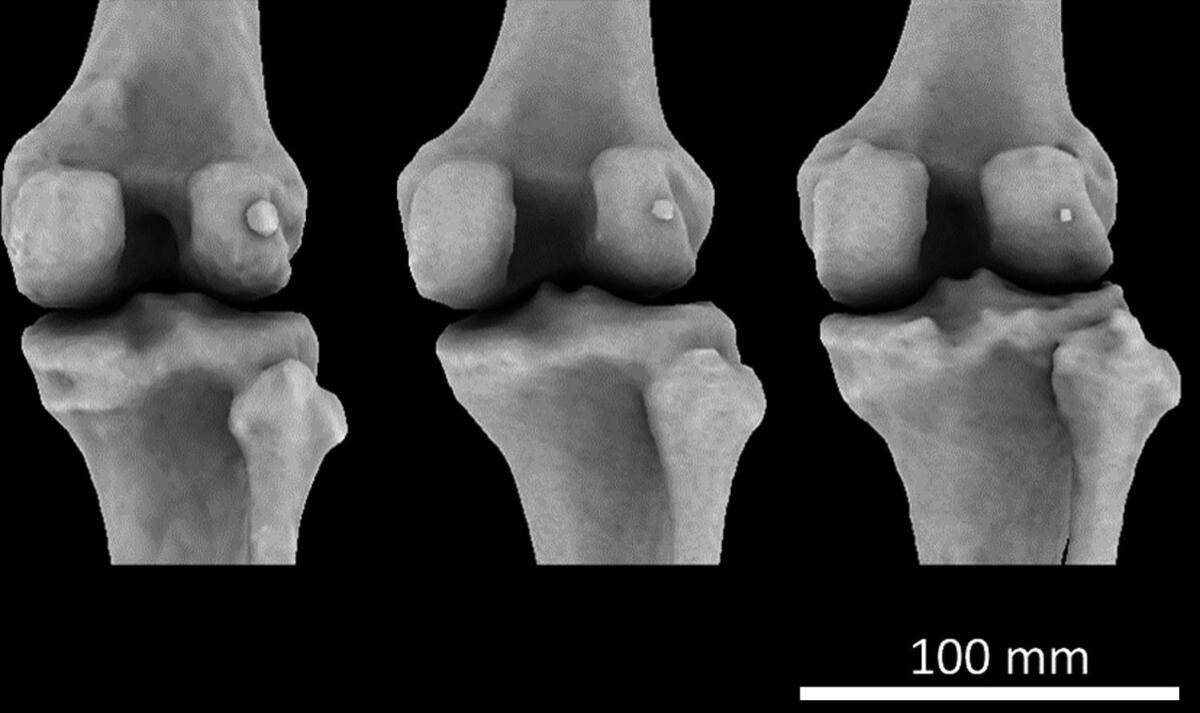 Abbiamo di nuovo la fabella, l'osso primordiale scomparso con l'evoluzione - fabella, crediti: Journal of Anatomy