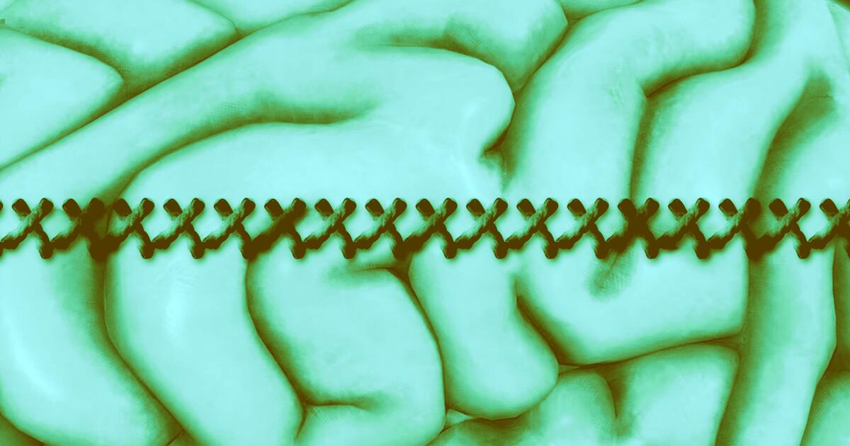 "Macchina da cucire" per il cervello: nuova frontiera delle Bci - Una "macchina da cucire" per il cervello. Credits: wp-assets.futurism.com